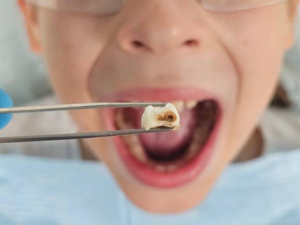 Best Emergency Dental Care for Trauma or Injury in Caryville, TN